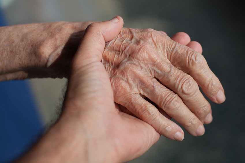 lossofychromosomeputsmenatalzheimersrisk